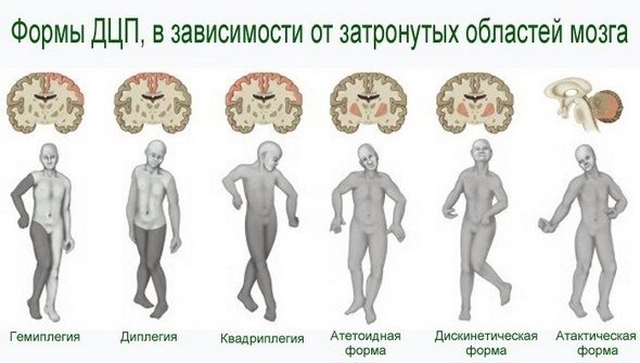 Вишневый пульс.