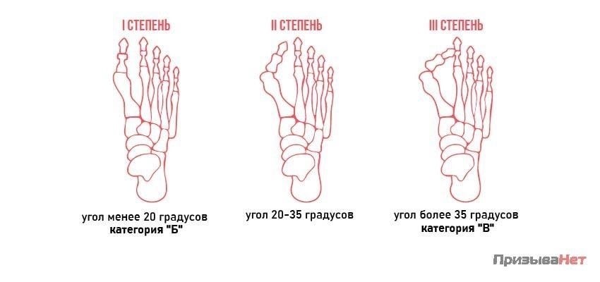 Опорно-двигательный аппарат: Переломы, деформации или нарушения, влияющие на подвижность, должны быть оценены, чтобы определить, сможет ли призывник справиться с физическими нагрузками.
