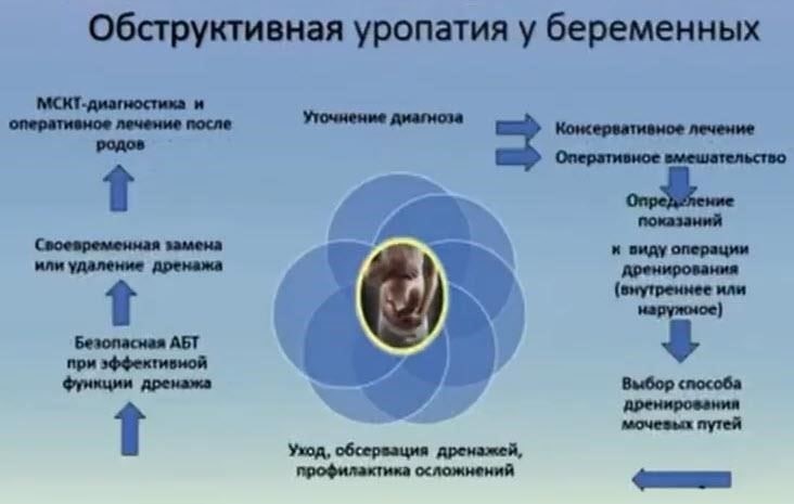 Обструктивная уропатия: Причины и стратегии лечения